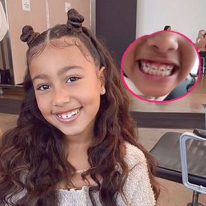 Ganz stolz: North West (8) zeigt jetzt ihre feste Zahnspange