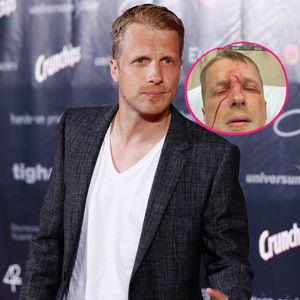 Nach Unfall: Oli Pocher postet ein blutiges Schockfoto!
