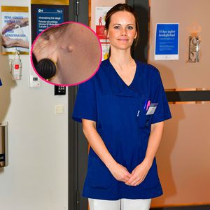 Beauty-Eingriff? Sofia von Schweden plötzlich ohne Muttermal