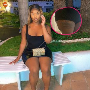 Influencerin kann nach drei Po-Operationen kaum noch laufen
