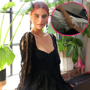 "Anaphylaktischer Schock": Romina Palm ist im Krankenhaus!