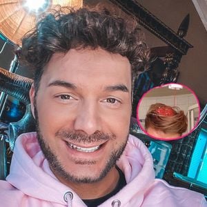 Wunderwaffe? Sam Dylan schwört bei Haarwäsche auf Ketchup