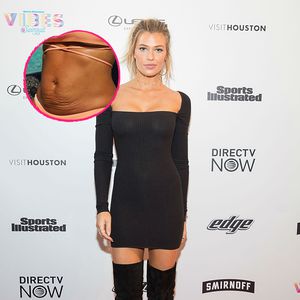 Sports-Illustrated-Model teilt ehrliches After-Baby-Body-Pic