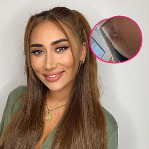 Eine Woche nach Geburt: Samira Klampfl zeigt ihren Bauch