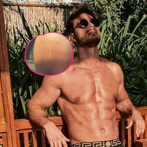 "Karriereende": Daher stammt Sebastian Panneks Schulternarbe