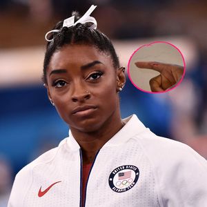 Simone Biles wurde von einem Deutschen Schäferhund gebissen