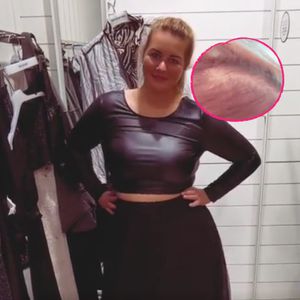 Wegen Abnahme: "Biggest Loser"-Melissa hatte Haarausfall