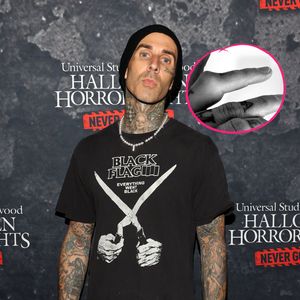 Autsch! Travis Barker bricht sich vor Welttournee den Finger