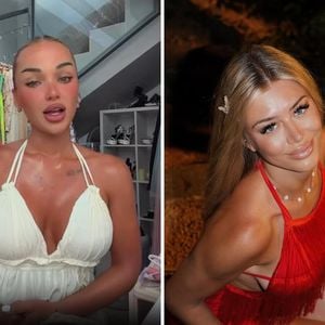 Wegen ihrer Beauty-OP: Emmy Russ und Chiara zoffen sich