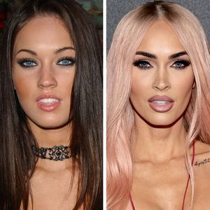 Beauty Doc erkennt: Legte sich Megan Fox doch unters Messer?