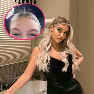 Wegen ihrer Schwangerschaft: Dagi Bee brechen die Haare ab