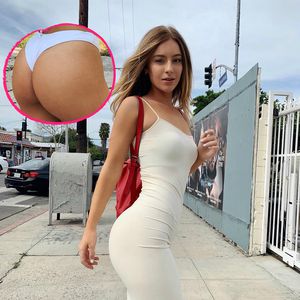 Beauty-Doc beweist: Po-Backen von Influencerin sind echt!