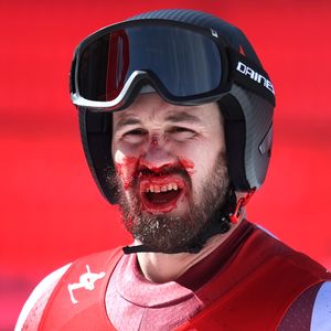 Mit Skistock: Olympionik schlägt sich selbst die Nase blutig