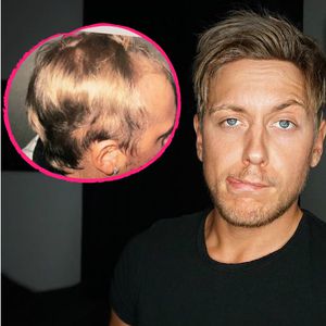 "Köln 50667"-Star Danny Liedtke litt früher an Haarausfall!