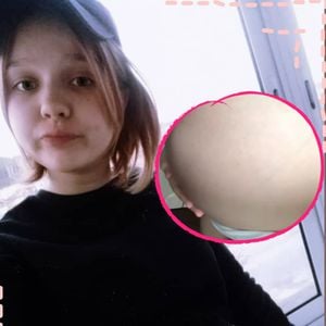 Countdown: Hochschwangere Darya (14) zeigt XXL-Babybauch