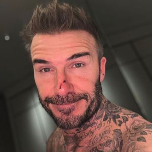 Beim Kitzeln: David Beckham von Tochter Harper gebissen