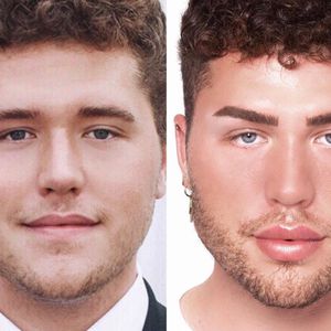 Vorher-Nachher: Beauty-Eingriffe von "Prince Charming"-David