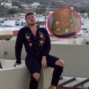 Nach Bodyshaming: "Prince Charming"-David beim Fettabsaugen