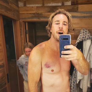 Rippen und Schulter gebrochen: Dax Shepard hatte Unfall!