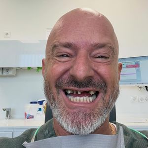 Detlef Steves ohne Zähne: Der Spott im Netz enttäuscht ihn