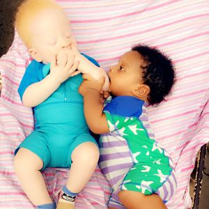 Süßes Wunder: Twins mit unterschiedlicher Hautfarbe geboren!