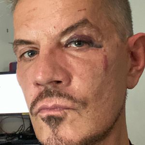 "Masters of Dance"-Juror Dirk Heidemann wurde verprügelt!