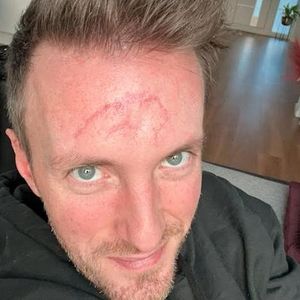 Nach schwerem Unfall: DJ Jerome gibt ein Gesundheitsupdate!