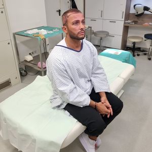 So geht es Domenico De Cicco nach der Haartransplantation