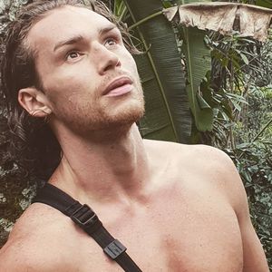 Botox-Bromance: Bachelorette-Eddy & Manu beim Beauty-Doc!