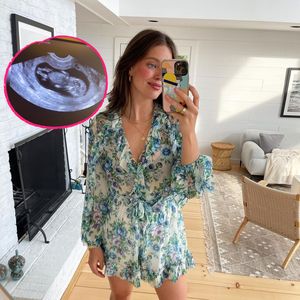 Mit Ultraschallbild: Model Emily DiDonato wird erneut Mama