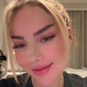 Völlig anders: Emma Fernlund zeigt nach OP ihr neues Gesicht