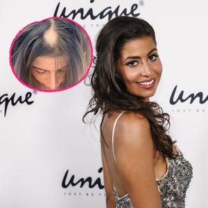 Bachelor-Star Eva Benetatou offen: Sie leidet an Haarausfall