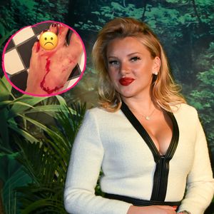 Blutender Fuß: So schlimm hat sich Evelyn Burdecki verletzt