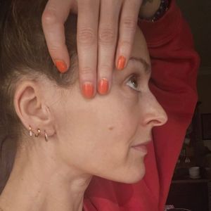 Fearne Cotton zeigt stolz Tumor-Narben nach erfolgreicher OP