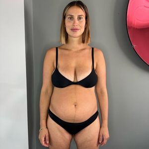 Ehrliches Bild: Ferne McCann macht Frauen nach Geburt Mut!