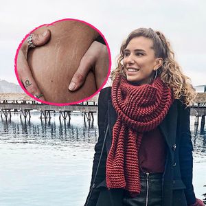 Anja Zeidler superoffen: Sie zeigt ihre Dehnungsstreifen!