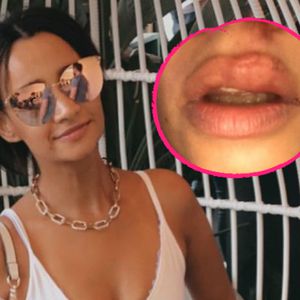 Ex-Queensberry Gabby riskiert beim Skaten eine dicke Lippe