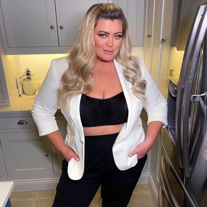 Gemma Collins ließ sich Botox und alle Filler entfernen