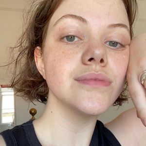 Gefährliche Infektion: Georgie Henley kämpfte um ihr Leben!