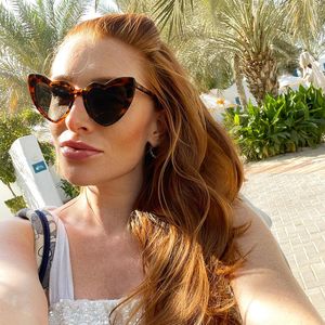 Wegen Blessuren: Georgina Fleur traut sich kaum noch raus