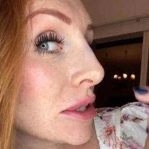 Hyaluron-Panne: Georgina Fleur mega-unzufrieden mit Nase!