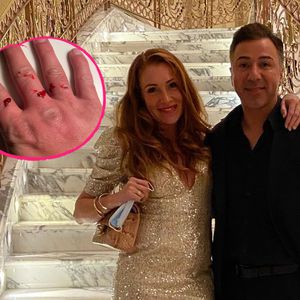 Blutige Hand! Georgina Fleur und Kubi streiten sich wieder