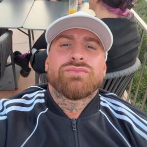 Er vermisst seine Jawline: Gigi Birofio lässt nachhelfen