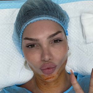 Giuliana Farfalla lässt sich "kleines Doppelkinn" absaugen