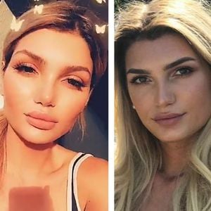 Tatsächlich: GNTM-Giuliana Farfalla hatte eine Nasen-OP