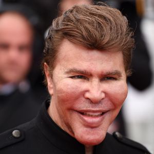 Botox-Zwilling Grichka Bogdanoff mit 72 Jahren gestorben