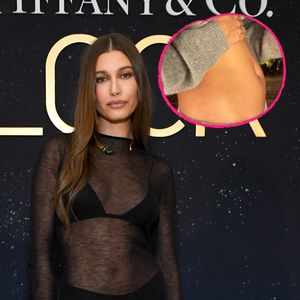 "Kein Baby": Hailey Bieber hat große Zyste am Eierstock!