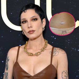 Weitere Endometriose-OP: Halsey zeigt sich in einer Windel