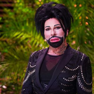 Vor Dschungel: Harald Glööckler ließ sich Achseln botoxen!