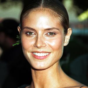 Wegen Pickeln: Heidi Klum als "Pizza-Gesicht" beschimpft